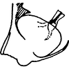 Pygofer, lateral view on Distantasca bulbosa (Dworakowska, 1994): Genital capsule, lateral view. (Observation).
