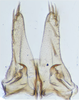Subgenital plate, ventral view on Exitianus nanus (Distant, 1908): (Observation).