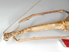 CollectionObject 1557399; 0e7fe868-4a1d-4bd3-af5b-c99814a9e649: copyright ZMB, Berlin. female: head and thorax of Bacteria bituberculata (holotype). (CollectionObject).
