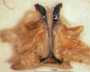 CollectionObject 1589085; 447db101-eaee-4486-8890-265d09e067ac: male titillators (paratype). (CollectionObject).
