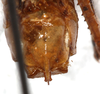 CollectionObject 1567637; 6b6d61b2-c7f3-40c6-abb2-500bf0a2454f: male abdomen tip, ventral view. (CollectionObject).