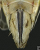 Ovipositor on Arocephalus (Ariellus) punctum (Flor, 1861): Ovipositor. (Observation).