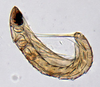 Other on Alocoelidia fulva Evans, 1954: Alocoelidia fulva, internal strepsipteran parasite (CAS). (Observation).