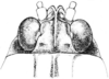 Platythorus toltecus (Saussure, 1861): Fig. 136. female, head, dorsal view. (Otu).