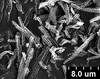 Brochosomes: !! display not done !! on Pseudophera Melichar, 1924: PP22 | Colom[bia] | C. F. Baker | USNM. (Observation).