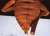 CollectionObject 1520442; dc1b4055-785a-4ef1-8230-ed8026aaa4e0: male abdomen tip, dorsal view (lectoype). (CollectionObject).