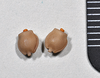 CollectionObject 1559518; NHMUK(SF IMPORT DUPLICATE) BMNH(E)845356, 0dc0db9c-24e0-46c7-9c2e-e9e72463fec1: copyright Natural History Museum, London. female, eggs. (CollectionObject).