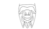 Balachowskyacris cerciata Descamps & Amédégnato, 1972: Fig. 138. male abdomen tip, dorsal view. (Otu).