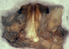 CollectionObject 1566136; 3f24be63-800e-444b-af14-9035251fcd0e: male titillators (syntype). (CollectionObject).