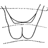 Abdomen, sternal apodemes, ventral view on Dziwneono olszewskii Dworakowska, 1972: Abdomen, sternal apodemes, ventral view. (Observation).