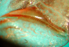 CollectionObject 1502476; 7c344548-1a7e-4e26-bc00-4e61cede82a1: male stridulatory file. (CollectionObject).