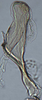 Aedeagus, lateral view: !! display not done !! on Matsumurasca (Matsumurasca) dolonis (Oman, 1936): (Observation).