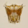 Subgenital plate: (Observation).