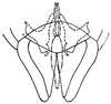 Subgenital plate: !! display not done !! on Polyamia (Copolyamia) apicata (Osborn, 1900): genital capsule, ventrally. (Observation).