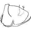Pygofer, lateral view on Distantasca latava (Dworakowska, 1981): Genital capsule, lateral view. (Observation).