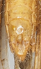 CollectionObject 1581310; ed1023fd-61dc-4eff-aade-5178bf404a7a, NHMUK10924580: male abdomen tip, ventral view. (CollectionObject).