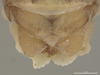 CollectionObject 1593807; a9000780-c3c0-4d1a-9895-19e4246dfe18: Male, postabdomen, dorsal view (holotype). (CollectionObject).