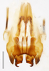 CollectionObject 1585130; 9d597fae-4945-46e2-abd6-81a7a73a2eb3: male genitalia, dorsal view (scale bar 0.5 mm). (CollectionObject).
