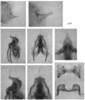 Melanoplus puer (Scudder, 1878): male genitalia. (Otu).