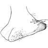 Pygofer, lateral view on Bolanusoides heros Distant, 1918: Pygofer lobe, lateral view. (Observation).