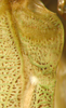 CollectionObject 1564888; a45e9ff3-bd9d-4654-a877-62d9c69fa87f: male stridulatory area enlaged (paratype). (CollectionObject).