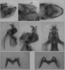 Melanoplus borealis (Fieber, 1853): male genitalia. (Otu).