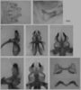 Melanoplus flabellatus (Scudder, 1878): male genitalia. (Otu).