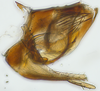 Pygofer, lateral view: (Observation).