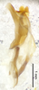 CollectionObject 1477623; ffbb23c7-dee5-4ea0-ba2b-6d9fe06574be, ANSP1116: male genitalia, lateral view (holotype). (CollectionObject).