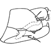 Pygofer, lateral view on Dicraneurula exigua (Vilbaste, 1968): Pygofer, lateral view (D. silvicola Vilbaste, 1968). (Observation).