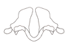 Zoniopoda serrana Pocco, Rubio & Cigliano, 2011: epiphallus, frontal view. (Otu).