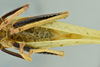 CollectionObject 1532034; 2d020a22-afbf-444f-a5ce-26692f31f857: male abdomen and terminalia, ventral view (syntype). (CollectionObject).