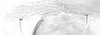 Forewing. on Aphis (Bursaphis) oenotherae Oestlund, 1887 alate viviparous female: Hairs on eighth abdominal tergite of A. oenotherae. (Observation).