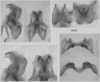 Melanoplus trigeminus Strohecker, 1963: male genitalia. (Otu).