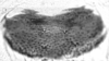 Aedeagus, lateral view.: Hairs on subgenitaI plate of A. sambuci. (Observation).