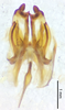 CollectionObject 1523744; 3fac1c77-325b-4392-b4ee-76d2554f09a3: male genitalia, ventral view (holotype). (CollectionObject).