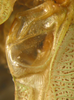 CollectionObject 1564888; a45e9ff3-bd9d-4654-a877-62d9c69fa87f: male right stridulatory area, enlarged (paratype). (CollectionObject).