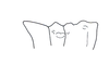 Rhabdophilacris curtipennis Descamps, 1976: Fig. 37. male, pronotal crest, lateral view. (Otu).