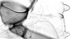 Stylus.: First and second marginal tubercles and coxa of A. pomi. (Observation).