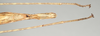 CollectionObject 1562737; 932440d7-0230-4ede-bc39-bfad00f3fbd9: copyright QMBA. female: end of abdomen, ventral view (paratype). (CollectionObject).