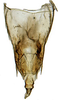 Pygofer, dorsal view on Paraboloponina Ishihara, 1953 now Drabescina Ishihara, 1953: Parabolopona webbi, pygofer, dorsally (INHS). (Observation).