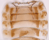 Abdomen, sternal apodemes, ventral view: (Observation).