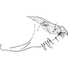 Pygofer, lateral view on Dziwneono olszewskii Dworakowska, 1972: Pygofer, lateral view. (Observation).