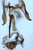 Aedeagus, ventral view: !! display not done !! on Scaphytopius nigricollis (Ball, 1916): Ohio State U. (Observation).