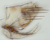 Pygofer, lateral view: (Observation).