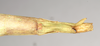 CollectionObject 1558414; NHMUK(SF IMPORT DUPLICATE) 845091, 59589231-d97c-45df-9f99-8e020a149c35: copyright Natural History Museum, London. female: end of abdomen, ventral view of synonym Phasma (Diura) roseipennis (holotype). (CollectionObject).