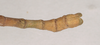 CollectionObject 1557609; NHMUK(SF IMPORT DUPLICATE) 845243, 394b3b61-6a8d-41f5-a1aa-1f76924523c8: copyright Natural History Museum, London. male: end of abdomen, dorsal view of Bacteria spinosa (holotype). (CollectionObject).