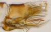 Pygofer, lateral view: (Observation).