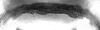 Forewing.: Hairs on eighth abdominal tergite of A. craccivora. (Observation).
