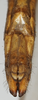 CollectionObject 1581312; b82e09b1-74d4-4b48-87f6-5709a98ac2c5, NHMUK10924578: female abdomen tip, ventral view. (CollectionObject).